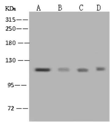 Western Blot: NCAPH Antibody [NBP2-97603] - Anti-NCAPH rabbit polyclonal antibody at 1:500 dilution. Lane A: HeLa Whole Cell Lysate Lane B: HepG2 Whole Cell Lysate Lane C: Jurkat Whole Cell Lysate Lane D: K562 Whole Cell Lysate Lysates/proteins at 30 ug per lane. Secondary Goat Anti-Rabbit IgG (H+L)/HRP at 1/10000 dilution. Developed using the ECL technique. Performed under reducing conditions. Predicted band size: 83 kDa