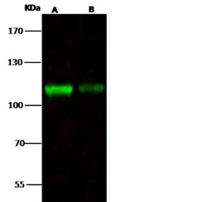 Western Blot: NCAPH Antibody [NBP2-98781] - Lane A: K562 Whole Cell LysateLane B: HepG2 Whole Cell LysateLysates/proteins at 30 ug per lane.SecondaryGoat Anti- Rabbit  IgG H&L (Dylight 800)  at 1/10000 dilution.Developed using the Odyssey technique. Performed under reducing conditions.Predicted band size:82 kDaObserved band size:110 kDa