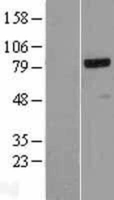 Western Blot: NCAPH Overexpression Lysate (Adult Normal) [NBL1-13505] Left-Empty vector transfected control cell lysate (HEK293 cell lysate); Right -Over-expression Lysate for NCAPH.