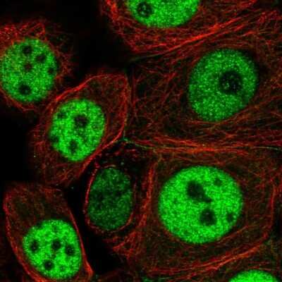 Immunocytochemistry/Immunofluorescence: NCAPH2 Antibody [NBP2-49580] - Staining of human cell line MCF7 shows localization to nucleoplasm & cell junctions. Antibody staining is shown in green.