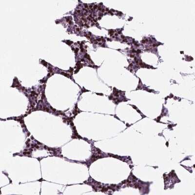 Immunohistochemistry-Paraffin: NCAPH2 Antibody [NBP2-49580] - Staining of human bone marrow shows high expression.