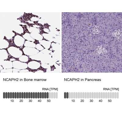 Immunohistochemistry-Paraffin: NCAPH2 Antibody [NBP2-49580] - Staining in human bone marrow and pancreas tissues using anti-NCAPH2 antibody. Corresponding NCAPH2 RNA-seq data are presented for the same tissues.