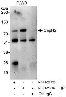 Immunoprecipitation: NCAPH2 Antibody [NBP1-28682] - Samples: Whole cell lysate (1 mg for IP, 20% of IP loaded) from HeLa cells.   Antibodies: Affinity purified rabbit anti-CapH2 antibody NBP1-28682 used for IP at 10 ug/mg lysate.  CapH2 was also immunoprecipitated by rabbit anti-CapH2 antibody NBP1-28723, which recognizes an upstream epitope.  For blotting immunoprecipitated CapH2, NBP1-28723 was used at 1 ug/ml.  Detection: Chemiluminescence with an exposure time of 3 minutes.