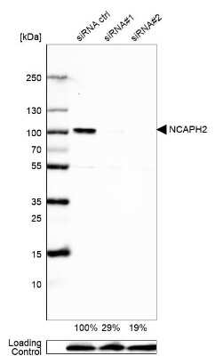 <b>Genetic Strategies Validation and Orthogonal Strategies Validation.</b>Western Blot: NCAPH2 Antibody [NBP2-49580] - Analysis in U2OS cells transfected with control siRNA, target specific siRNA probe #1 and #2,. Remaining relative intensity is presented. Loading control: Anti-GAPDH.