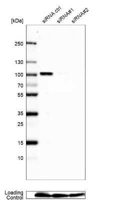 Western Blot: NCAPH2 Antibody [NBP2-57498] - Analysis in U2OS cells transfected with control siRNA, target specific siRNA probe #1 and #2,. Remaining relative intensity is presented. Loading control: Anti-GAPDH.