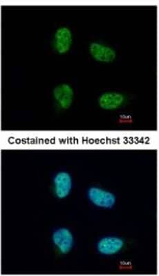 Immunocytochemistry/Immunofluorescence: NCBP1 Antibody [NBP2-19484] - Analysis of paraformaldehyde-fixed HeLa, using antibody at 1:200 dilution.