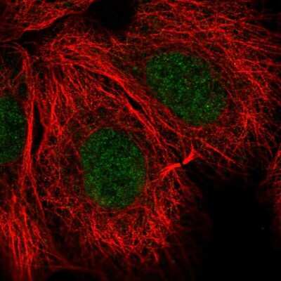 Immunocytochemistry/Immunofluorescence: NCBP1 Antibody [NBP2-33546] - Immunofluorescent staining of human cell line A-431 shows localization to nucleoplasm.
