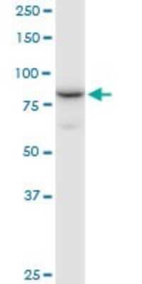 Western Blot: NCBP1 Antibody [H00004686-B01P] - Analysis of NCBP1 expression in Jurkat.