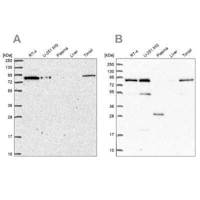Western Blot: NCBP1 Antibody [NBP2-33546] - Analysis using Anti-NCBP1 antibody NBP2-33546 (A) shows similar pattern to independent antibody NBP2-33897 (B).