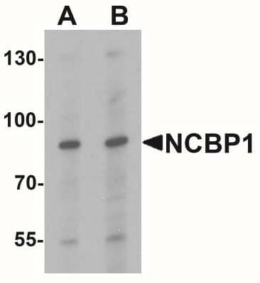 Western Blot: NCBP1 Antibody [NBP2-41222] - Western blot analysis of NCBP1 in HeLa cell lysate with NCBP1 antibody at (A) 1 and (B) 2 ug/mL.