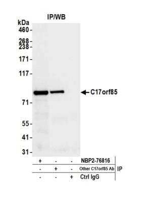Immunoprecipitation: NCBP3 Antibody [NBP2-76816] - Detection of human C17orf85 by western blot of immunoprecipitates. Samples: Whole cell lysate (1.0 mg per IP reaction; 20% of IP loaded) from HeLa cells prepared using NETN lysis buffer. Antibodies: Affinity purified Rabbit anti-C17orf85 antibody NBP2-76816 used for IP at 100 ul per reaction. C17orf85 was also immunoprecipitated by another rabbit anti-C17orf85 antibody. For blotting immunoprecipitated C17orf85, NBP2-76816 was used at 1:1000. Detection: Chemiluminescence with an exposure time time of 3 seconds.