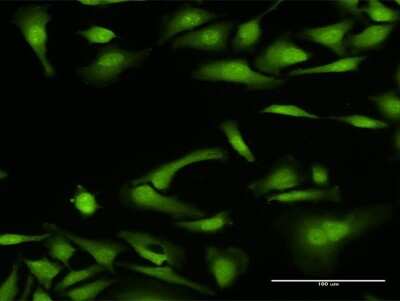 Immunocytochemistry/Immunofluorescence: NCF4 Antibody [H00004689-D01P] - Analysis of antibody to NCF4 on HeLa cell. Antibody concentration 20 ug/ml.