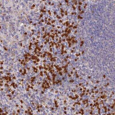 Immunohistochemistry-Paraffin: NCF4 Antibody [NBP2-32720] - Staining of human spleen shows strong cytoplasmic positivity in a subset of cells in red pulp.