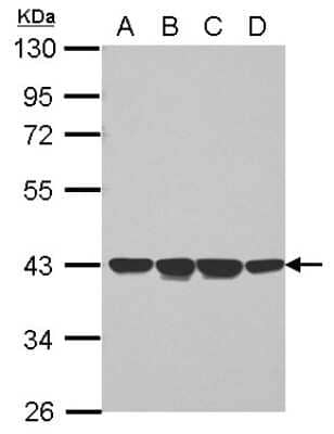 Western Blot: NCF4 Antibody [NBP2-19488] - Sample (30 ug of whole cell lysate) A: Jurkat B: Raji C: K562 D: THP-1 10% SDS PAGE gel, diluted at 1:1000.