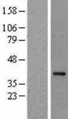 Western Blot: NCF4 Overexpression Lysate (Adult Normal) [NBL1-13511] Left-Empty vector transfected control cell lysate (HEK293 cell lysate); Right -Over-expression Lysate for NCF4.