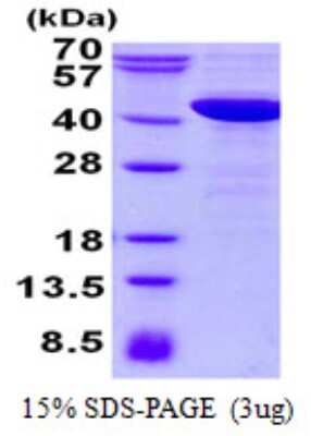 SDS-PAGE Recombinant Human NCF4 His Protein