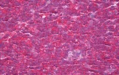 Immunohistochemistry-Paraffin: NCK1 Antibody (11D10) [NBP2-11535] - Analysis of anti-NCK1 antibody with human tonsil at dilution 1:200.