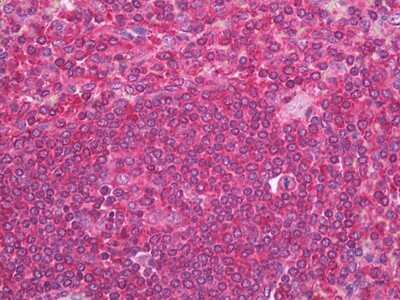Immunohistochemistry-Paraffin: NCK1 Antibody (11D10) [NBP2-11535] - Analysis of anti-NCK1 antibody with human spleen at dilution 1:200.