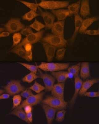 Immunocytochemistry/Immunofluorescence: NCK1 Antibody (4R1N9) [NBP3-16759] - Immunofluorescence analysis of NIH-3T3 cells using NCK11 Rabbit mAb (NBP3-16759) at dilution of 1:100 (40x lens). Blue: DAPI for nuclear staining.