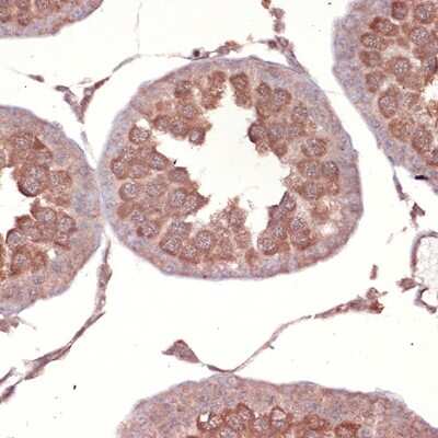 Immunohistochemistry-Paraffin: NCK1 Antibody (4R1N9) [NBP3-16759] - Immunohistochemistry of paraffin-embedded rat testis using NCK11 Rabbit mAb (NBP3-16759) at dilution of 1:100 (40x lens).Perform microwave antigen retrieval with 10 mM Tris/EDTA buffer pH 9.0 before commencing with IHC staining protocol.