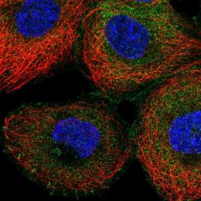 Immunocytochemistry/Immunofluorescence: NCK1 Antibody [NBP2-55255] - Staining of human cell line A-431 shows localization to plasma membrane & cytosol.