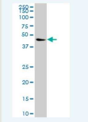Western Blot: NCK1 Antibody [H00004690-B01P-50ug] - NCK1 MaxPab polyclonal antibody. Western Blot analysis of NCK1 expression in A-431.
