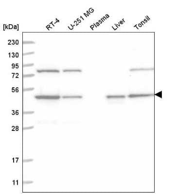 Western Blot: NCK1 Antibody [NBP2-55255] - Western blot analysis in human cell line RT-4, human cell line U-251 MG, human plasma, human liver tissue and human tonsil tissue.