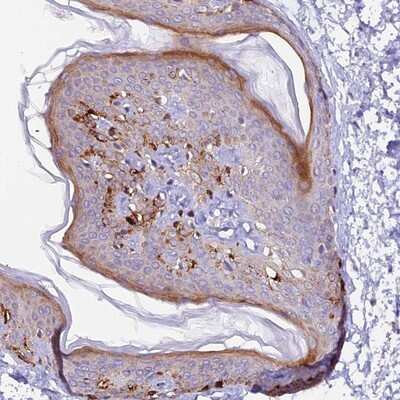 Immunohistochemistry-Paraffin: NCK2 Antibody [NBP1-82592] - Staining of human skin shows strong cytoplasmic positivity in subsets of cells.