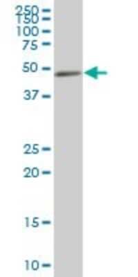 Western Blot: NCK2 Antibody [H00008440-B01P] - Analysis of NCK2 expression in human spleen.