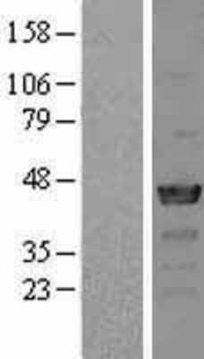 Western Blot: NCK2 Overexpression Lysate (Adult Normal) [NBL1-13512] Left-Empty vector transfected control cell lysate (HEK293 cell lysate); Right -Over-expression Lysate for NCK2.