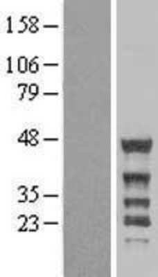 Western Blot: NCK2 Overexpression Lysate (Adult Normal) [NBL1-13513] Left-Empty vector transfected control cell lysate (HEK293 cell lysate); Right -Over-expression Lysate for NCK2.