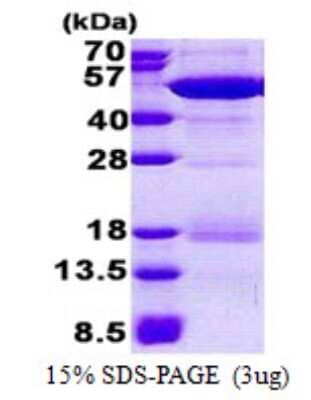 SDS-Page: NCK2 Protein [NBP2-23272]