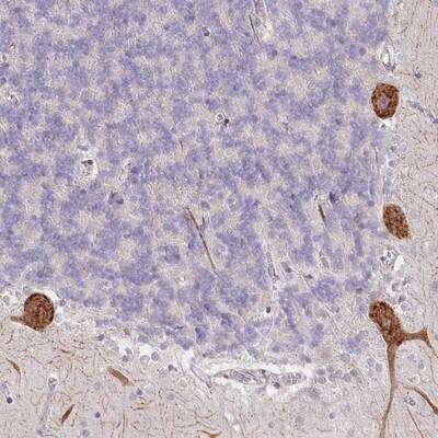 Immunohistochemistry-Paraffin: NCKAP5 Antibody [NBP1-90474] - Staining of human cerebellum shows strong cytoplasmic positivity in Purkinje cells.