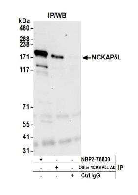 Immunoprecipitation: NCKAP5L Antibody [NBP2-78830] - Detection of human NCKAP5L by western blot of immunoprecipitates. Samples: Whole cell lysate (1.0 mg per IP reaction; 20% of IP loaded) from K-562 cells prepared using NETN lysis buffer. Antibodies: Affinity purified rabbit anti-NCKAP5L antibody NBP2-78830 used for IP at 100 ul per reaction. NCKAP5L was also immunoprecipitated by another rabbit anti-NCKAP5L antibody. For blotting immunoprecipitated NCKAP5L, NBP2-78830 was used at 1:1000. Detection: Chemiluminescence with an exposure time of 10 seconds.