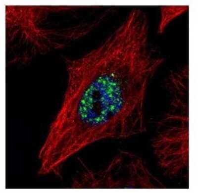 Immunocytochemistry/Immunofluorescence: NCOA2 Antibody [NBP2-19495] - Confocal immunofluorescence analysis of paraformaldehyde-fixed HeLa, using NCOA2 antibody (Green) at 1:500 dilution. Alpha-tubulin filaments are labeled with Alpha-tubulin antibody (Red) at 1:2000.