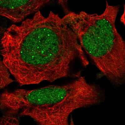 Immunocytochemistry/Immunofluorescence: NCOA2 Antibody [NBP2-55879] - Staining of human cell line U-2 OS shows localization to nucleoplasm & nuclear bodies.