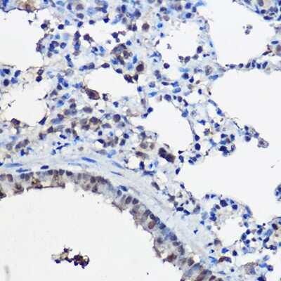 Immunohistochemistry-Paraffin: NCOA2 Antibody [NBP3-03763] - Rat lung using [KO Validated] NCOA2 Rabbit pAb (NBP3-03763) at dilution of 1:100 (40x lens). Perform high pressure antigen retrieval with 10 mM citrate buffer pH 6.0 before commencing with IHC staining protocol.