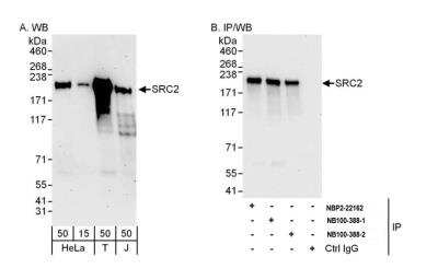 <b>Independent Antibodies Validation. </b>Immunoprecipitation: NCOA2 Antibody [NB100-388] - Detection of human NCOA2/ SRC2 by western blot and immunoprecipitation. Samples: Whole cell lysate from HeLa(15 and 50 ug for WB; 1 mg for IP, 20% of IP loaded), HEK293T (T; 50 ug) and Jurkat (J; 50 ug) cells. Antibodies: Affinity purified rabbit anti-NCOA2/SRC2 antibody NB100-388 (lot 2) used for WB at 0.1 ug/ml (A) and 1 ug/ml (B) and used for IP at 6 ug/mg lysate. SRC2 was also immunoprecipitated by a previous lot (lot 1) and by rabbit anti-NCOA1/SRC2 antibody NBP2-22162, which recognizes a downstream epitope. Detection: Chemiluminescence with exposure times of 3 minutes (A) and 10 seconds (B).