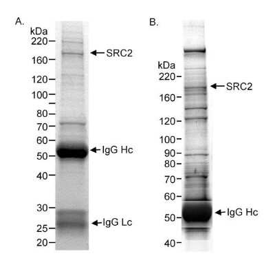 Immunoprecipitation: NCOA2 Antibody [NBP2-22162] - Immunoprecipitation: NCOA2 Antibody - Nuclear extract (A, 10 mg) or cytosolic (S100) extract (B, 10 mg) from HeLa cells.  Antibody:  Affinity purified rabbit NCOA2 used at 20 ug/10 mg lysate.  Detection:  Coomassie Brilliant Blue R250 staining of SDS-PAGE gel followed by mass spectrometry to confirm the identity of the band that is NCOA2.