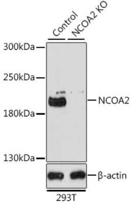 <b>Genetic Strategies Validation. </b>Knockout Validated: NCOA2 Antibody [NBP3-03763] - Analysis of extracts from normal (control) and NCOA2 knockout (KO) 293T cells, using NCOA2 antibody at 1:1000 dilution. Secondary antibody: HRP Goat Anti-Rabbit IgG (H+L) at 1:10000 dilution. Lysates/proteins: 25ug per lane.Blocking buffer: 3% nonfat dry milk in TBST.