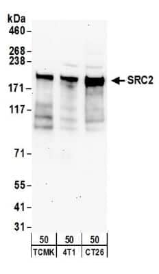 Western Blot: NCOA2 Antibody [NB100-388] - Detection of Mouse NCOA2/ SRC2 by Western Blot. Samples: Whole cell lysate (50 ug) from TCMK-1, 4T1, and CT26.WT cells. Antibodies: Affinity purified rabbit anti-NCOA2/SRC2 antibody NB100-388 used for WB at 1 ug/ml. Detection: Chemiluminescence with an exposure time of 3 minutes.