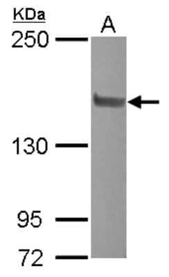 Western Blot: NCOA2 Antibody [NBP2-19495] - Sample (20 ug ) A: HeLa Nucleus 5% SDS PAGE gel, diluted at 1:500.