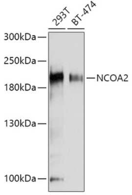 Western Blot: NCOA2 Antibody [NBP3-03763] - Analysis of extracts of various cell lines, using NCOA2 antibody at 1:1000 dilution. Secondary antibody: HRP Goat Anti-Rabbit IgG (H+L) at 1:10000 dilution. Lysates/proteins: 25ug per lane. Blocking buffer: 3% nonfat dry milk in TBST. Detection: ECL Basic Kit