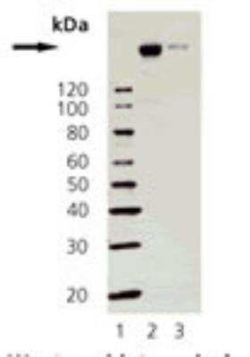 Western Blot: NCOA3/AIB1 Antibody (50B6) [NBP1-19201] - MCF- 7 and T-47D cell extracts. Lane 1: Molecular Weight Markers, Lane 2: MCF-7, Lane 3: T-47D