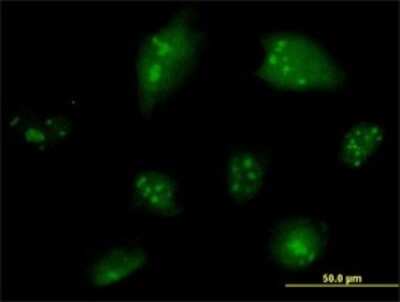 Immunocytochemistry/Immunofluorescence: NCOA6 Antibody (2D7) [H00023054-M01] - Analysis of monoclonal antibody to NCOA6 on HeLa cell. Antibody concentration 10 ug/ml.