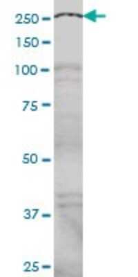 Western Blot: NCOA6 Antibody (2D7) [H00023054-M01] - NCOA6 monoclonal antibody (M01), clone 2D7 Analysis of NCOA6 expression in Hela S3 NE.