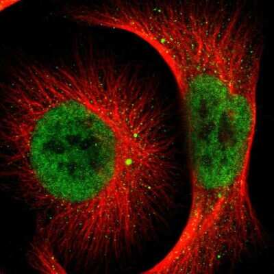 Immunocytochemistry/Immunofluorescence: NCOA6 Antibody [NBP1-89193] - Staining of human cell line U-251 MG shows localization to nucleoplasm & vesicles. Antibody staining is shown in green.