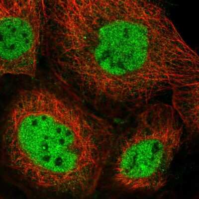 Immunocytochemistry/Immunofluorescence: NCOA6 Antibody [NBP2-55622] - Staining of human cell line A-431 shows localization to nucleoplasm.