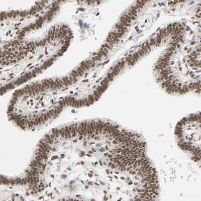 Immunohistochemistry-Paraffin: NCOA6 Antibody [NBP1-89193] - Staining of human fallopian tube shows moderate to strong nuclear positivity in glandular cells.