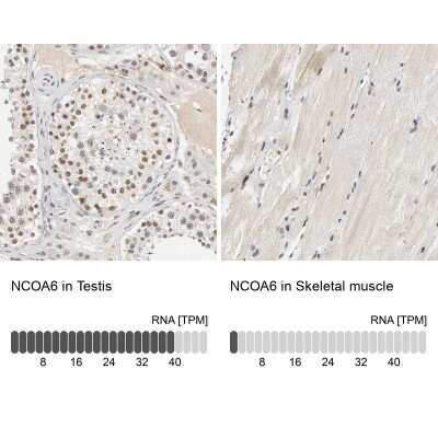 <b>Orthogonal Strategies Validation. </b>Immunohistochemistry-Paraffin: NCOA6 Antibody [NBP1-89193] - Staining in human testis and skeletal muscle tissues.. Corresponding NCOA6 RNA-seq data are presented for the same tissues.